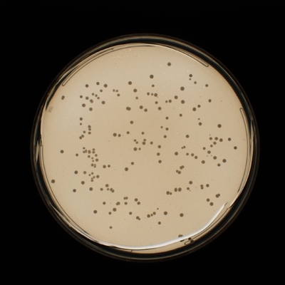 Agar Overlay testing_BP-website