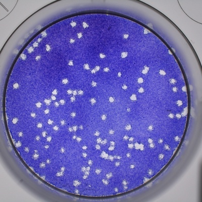 Plaque reduction assay-website